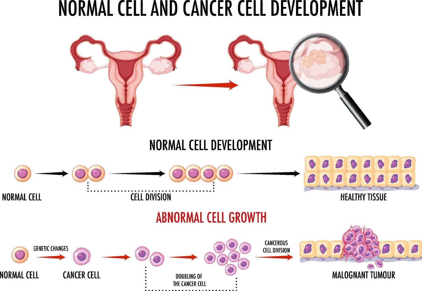 diagramme montrant une cellule normale et une cellule cancéreuse vecteur
