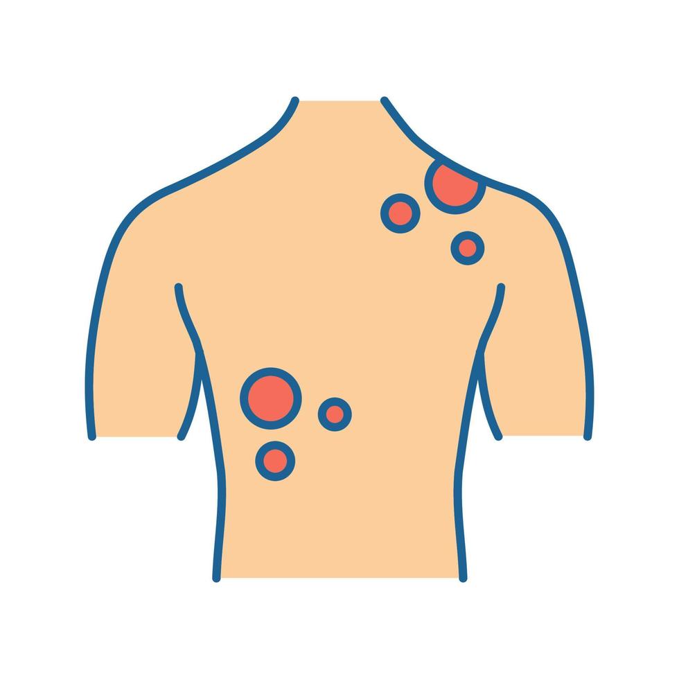 icône de couleur de cancer de la peau. maladies dermatologiques. éruption cutanée, taches sur le dos. mélanome. illustration vectorielle isolée vecteur
