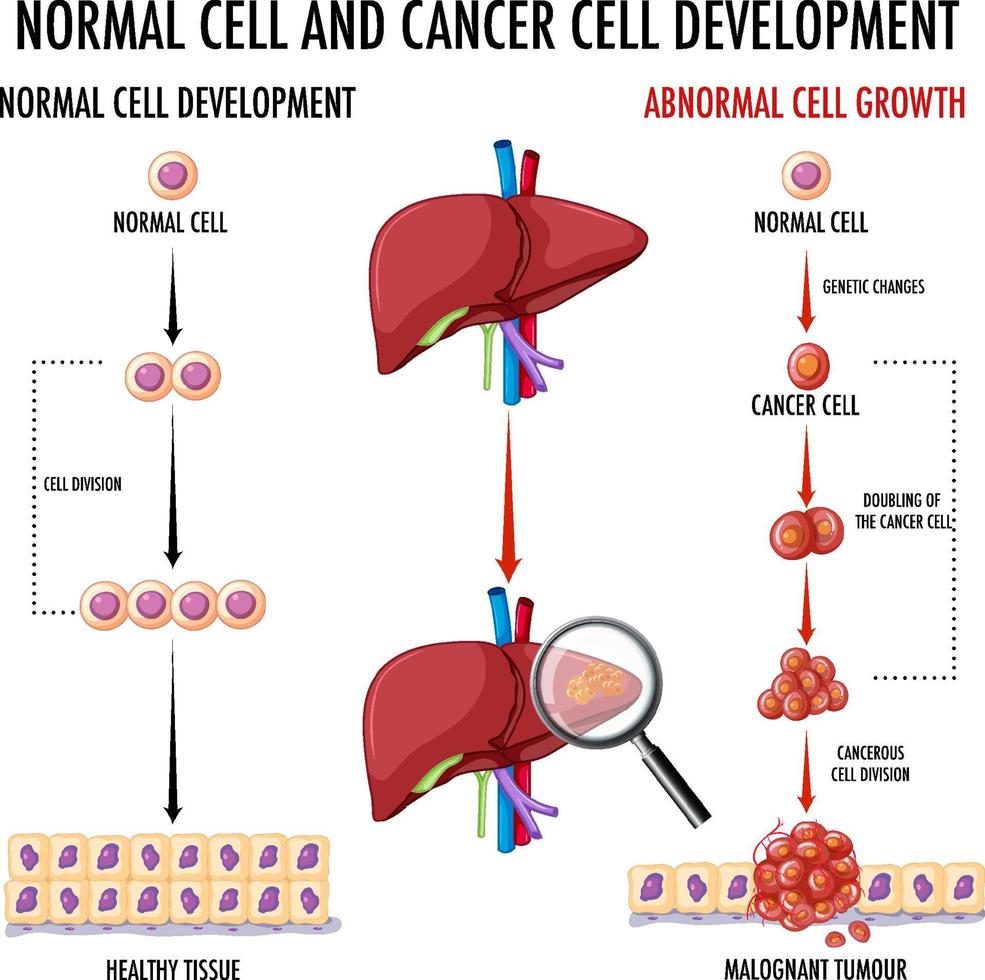 diagramme montrant une cellule normale et une cellule cancéreuse vecteur