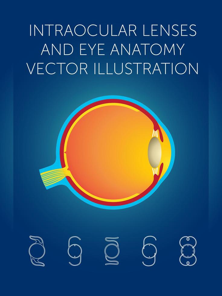 lentilles intraoculaires et illustration vectorielle de l'anatomie oculaire vecteur