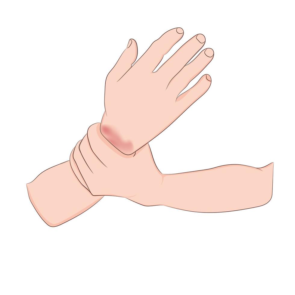 graphiques d'image contours vectoriels la douleur au poignet est souvent causée par des entorses ou des fractures dues à des blessures soudaines concept de soins de santé vecteur