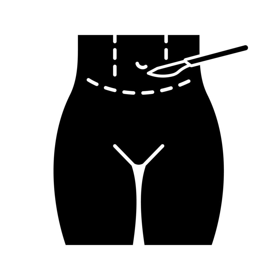 icône de glyphe en plastique de plastie abdominale. abdominoplastie. liposuccion de l'estomac. lifting abdominal. chirurgie esthetique. symbole de la silhouette. espace négatif. illustration vectorielle isolée vecteur