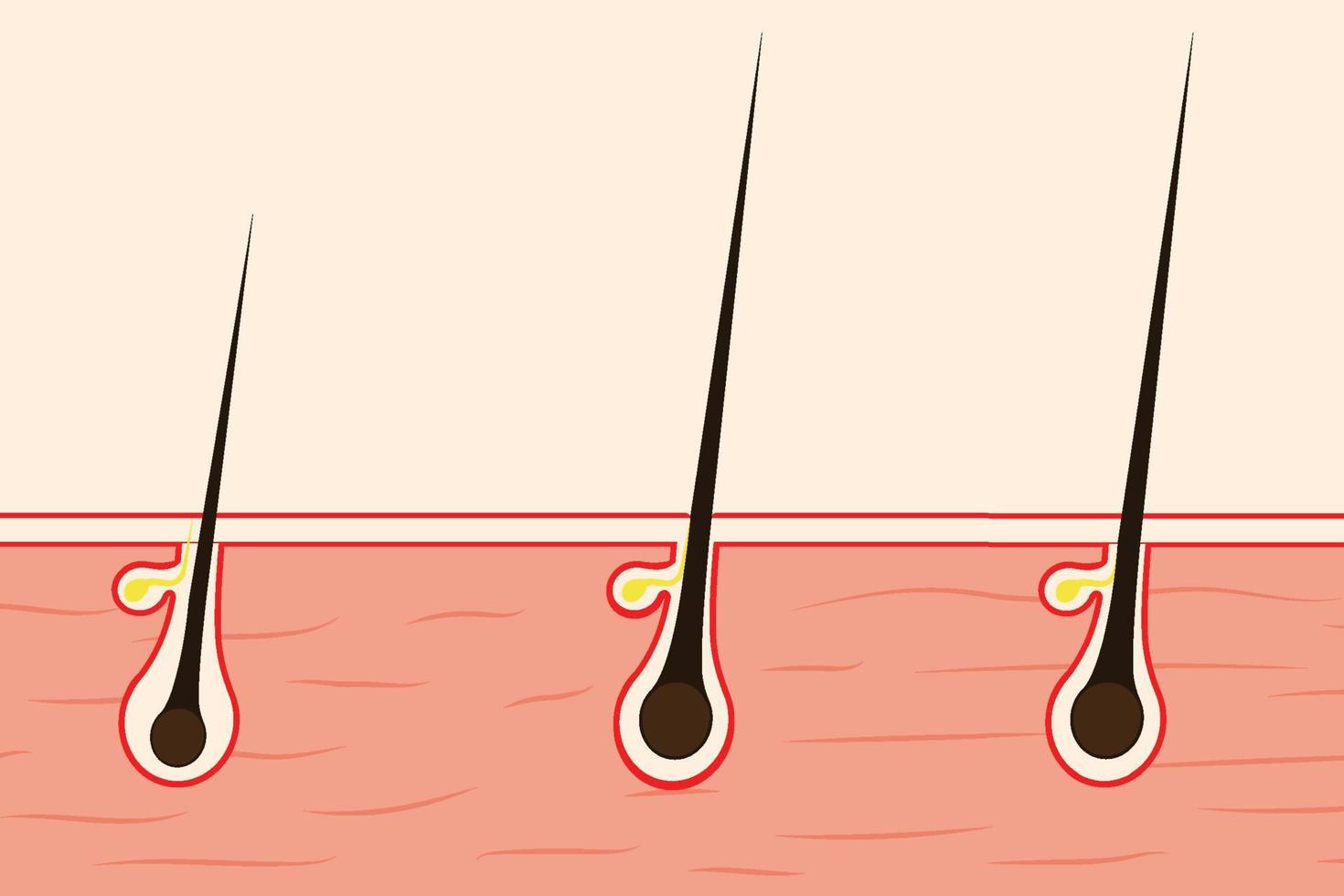 concept de croissance des cheveux avec une illustration de peau humaine. follicules pileux avec des sacs d'huile et des fils noirs sur la peau. phase de croissance anatomique des cheveux et étapes du vecteur du cycle de croissance des cheveux.