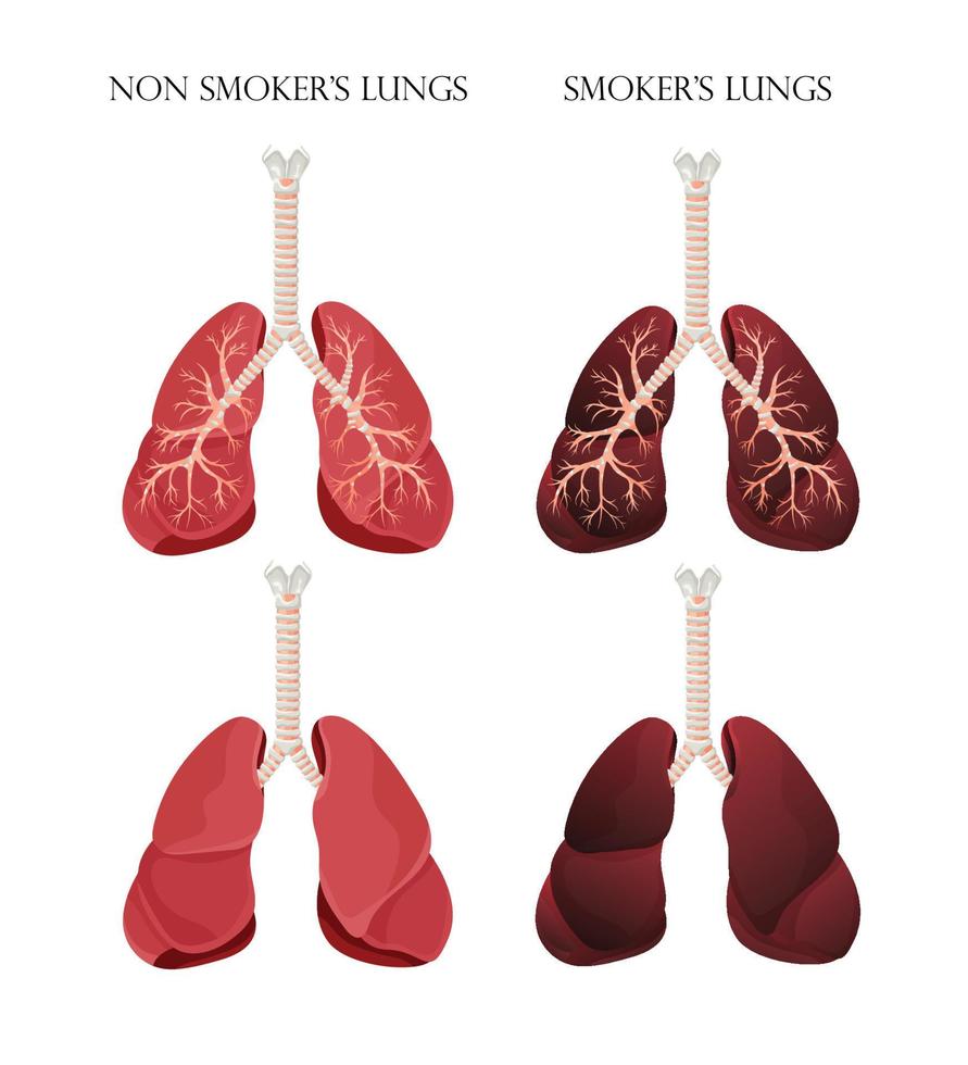 illustration de poumons sains normaux et d'un fumeur de poumons. concept d'arrêter de fumer. illustration vectorielle. vecteur