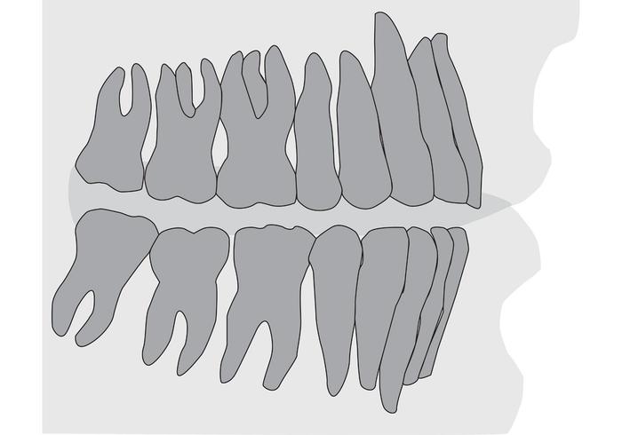 Radiographie des dents et des gommes vecteur