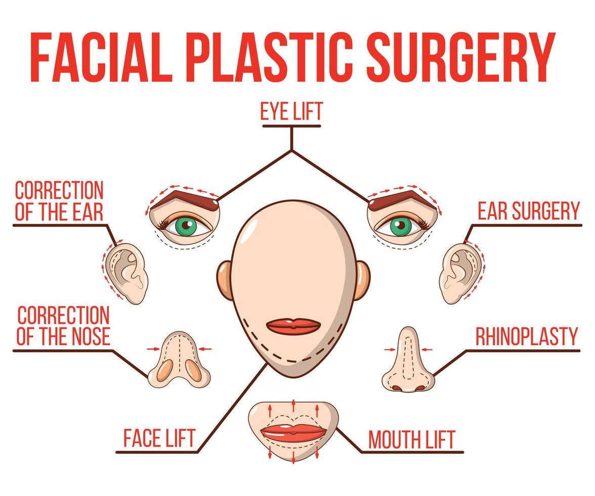 bannière de concept de chirurgie plastique faciale, style cartoon vecteur