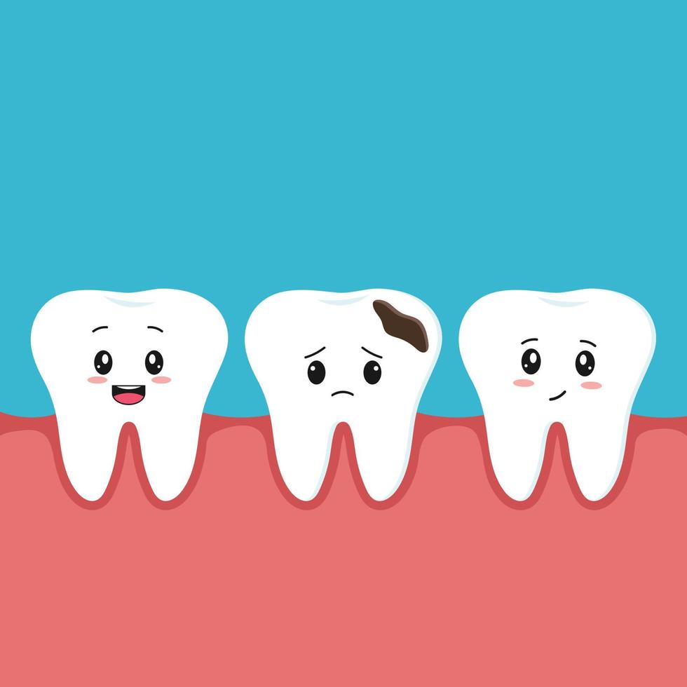 illustration vectorielle de dents de caractère saines avec des sourires et une dent triste avec carie et un trou dans les gencives. concept de dentisterie pour enfants. vecteur