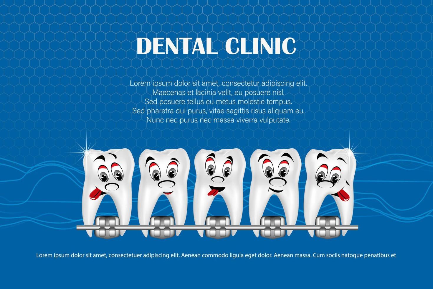 illustration vectorielle 3d, dents réalistes avec accolades mâchoire supérieure et inférieure. alignement de la morsure des dents, dentition avec accolades, accolades dentaires. vecteur