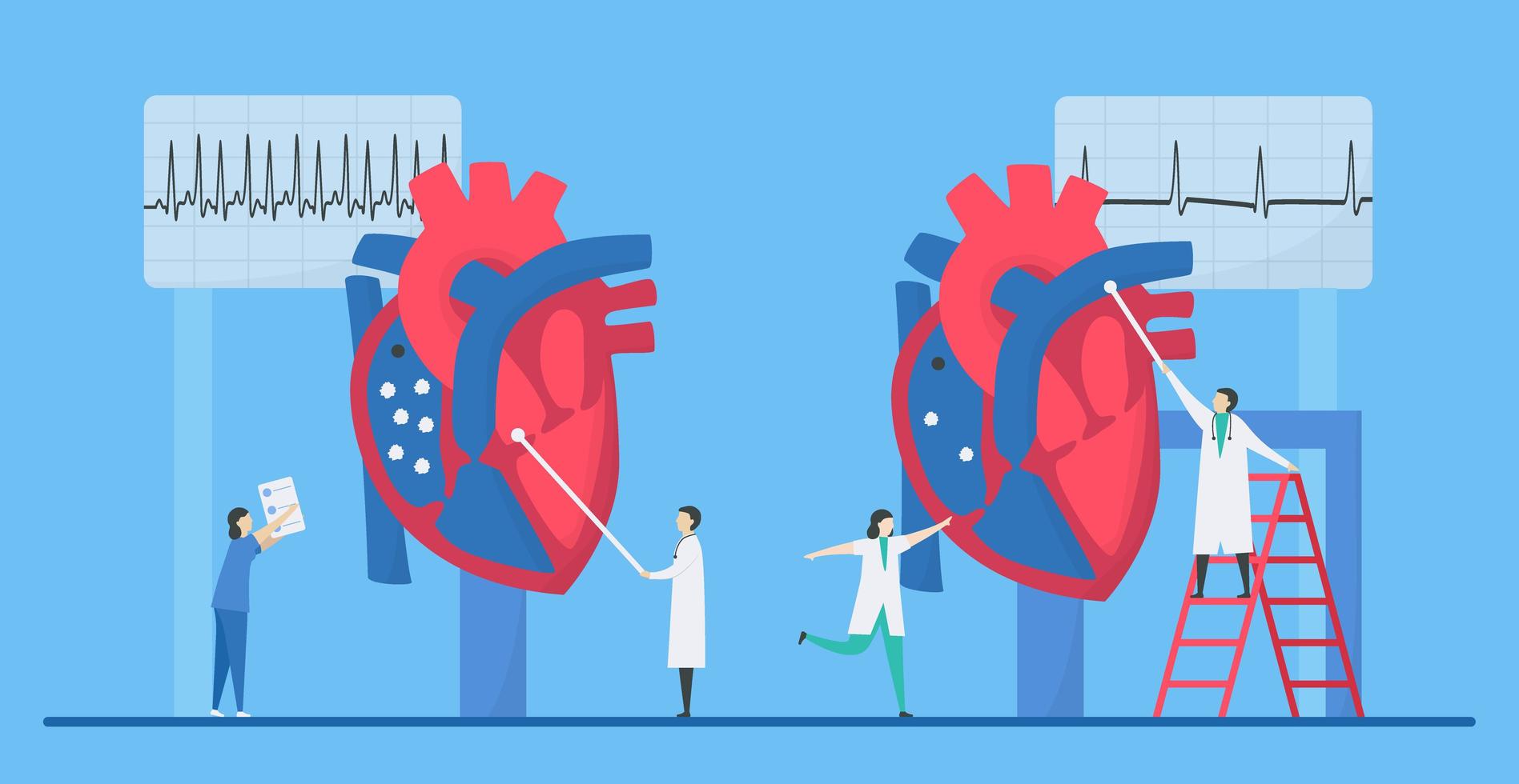 concept d'arythmie tachycardie cardiologie vecteur