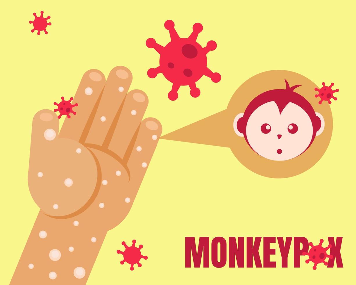 concept d'épidémie de monkeypox. mains avec virus. style de vecteur de dessin animé pour votre conception.