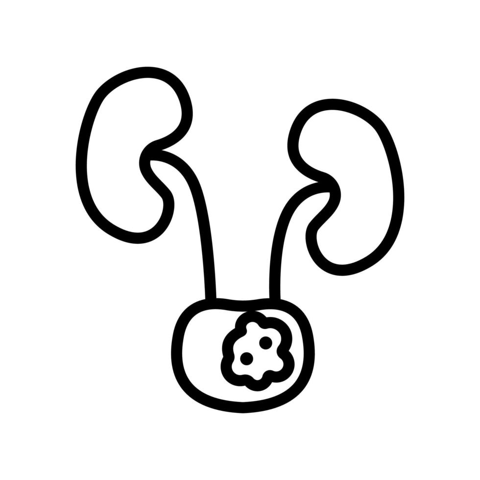 cancer, vecteur d'icône ovarienne. illustration de symbole de contour isolé