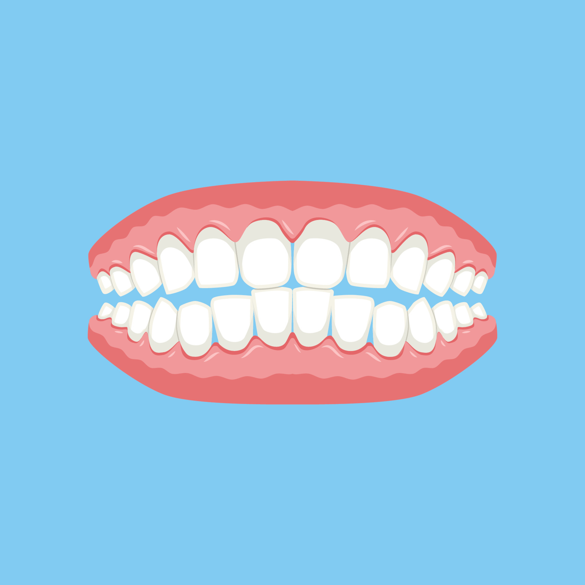 Fausses Dents Humaines - Prothèse Acrylique Permanente. Croquis Du Faux  Dentier. Clip Art Libres De Droits, Svg, Vecteurs Et Illustration. Image  168891198