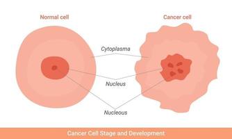 illustration du stade et du développement des cellules cancéreuses vecteur