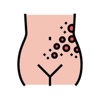 lichen zona maladie couleur icône illustration vectorielle vecteur