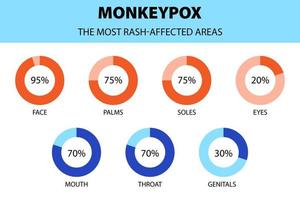 infographie du virus monkeypox. schéma des zones touchées les plus éruptives. nouveaux cas d'éclosion en europe et aux états-unis. vecteur