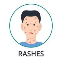 homme avec une peau irritée. informations sur les symptômes de la variole du singe. style plat, illustration vectorielle. vecteur