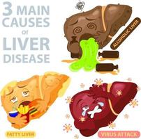 3 principales causes de maladie du foie vecteur