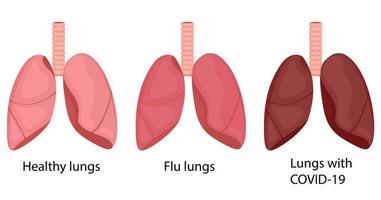poumons grippaux, covid-19, en bonne santé. changement de la couleur des poumons avec la maladie. illustration vectorielle en style cartoon. vecteur
