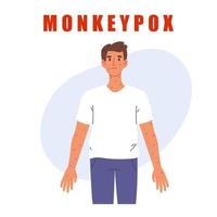 virus de la variole du singe. homme avec éruption cutanée. infections cutanées. infographie du virus monkeypox. illustration vectorielle isolée vecteur