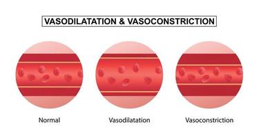 vasodilatation et vasoconstriction. comparaison des vaisseaux sanguins. vecteur