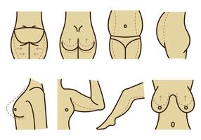 Ensemble de vecteur de chirurgie plastique