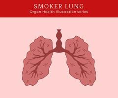 illustration de poumon de fumeur malade vecteur