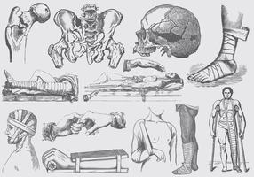 Illustrations de traitement de fracture grise vecteur