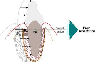 centre de résistance dans une dent et translation ou mouvement corporel vecteur