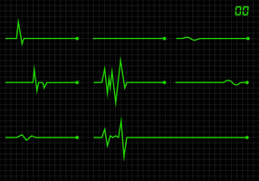 Vecteur flatline gratuit