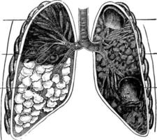 poumons, illustration vintage. vecteur