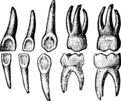 dents temporaires, illustration vintage. vecteur