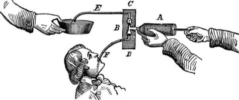 illustration vintage de la pompe à estomac. vecteur