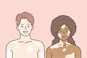 concept d'amour vitiligo et métis. jeune femme souriante et homme couple debout ensemble ayant du vitiligo sur les visages et les corps se sentant amour illustration vectorielle vecteur