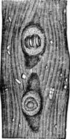 trichina spiralis ou trichinae, illustration vintage. vecteur