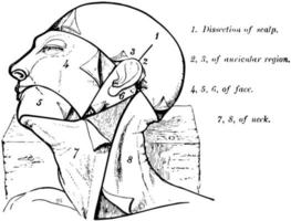 dissection de la tête illustration vintage vecteur