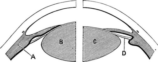 lentille de l'oeil ou changement de lentille pendant l'hébergement, illustration vintage. vecteur