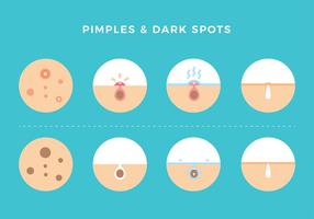 Pimples and Dark Spots Free Vector