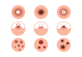 pimple icons vector