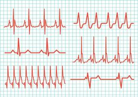 Icônes de vecteur de rythme cardiaque