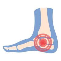 vecteur de dessin animé d'icône de douleur au talon. articulation de l'arthrite