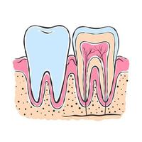 anatomie de la dent. dessin de style croquis. infographie en dentisterie. illustration vectorielle vecteur