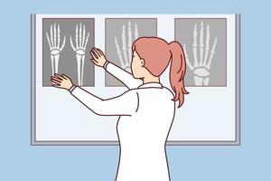 une femme chirurgienne applique une radiographie de la main sur un tableau lumineux pour voir les sites de fracture osseuse chez le patient. une infirmière se tient dos à l'écran en regardant des images faites après une fracture. conception de vecteur plat