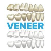 vecteur de placage. concept de placage dentaire. élément de conception de bannière médicale. dent avant et après. illustration