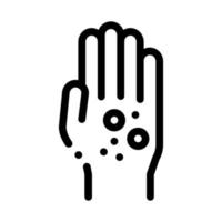 dermatite éruption cutanée sur les mains icône vecteur contour illustration
