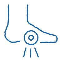 douleur au talon du pied élément orthopédique icône de doodle illustration dessinée à la main vecteur