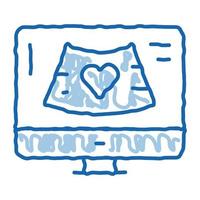 icône de doodle d'écran d'ordinateur de recherche sur l'hypertension illustration dessinée à la main vecteur