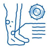 éruption cutanée sur les jambes doodle icône illustration dessinée à la main vecteur