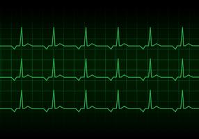 Vecteur de moniteur rythme cardiaque Heartbeat