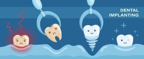 affiche d'opération dentaire montrant comment retirer la dent malade et la remplacer par un implant dentaire en titane. affiche de soins de santé, bannière pour cliniques dentaires et chirurgies. vecteur