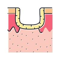 illustration vectorielle d'icône de couleur de cicatrice d'acné hypertrophique vecteur